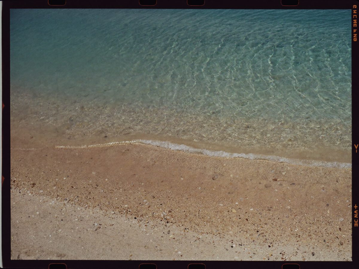 Conchal frame